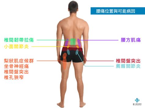 該邊位置|不明原因腰背痛、大腿前側該邊痛？你可能是髂腰肌症候群